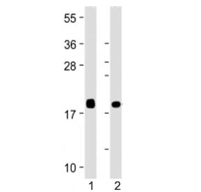 Western blot testing of VILIP1 antibody at 1:4000: Lane 1) human brain and 2) human cerebellum lysat