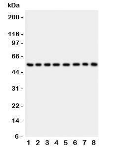 Western blot testing of P2X2 antibody and Lane 1: rat brain; 2: mouse brain; 3: human placenta; 4: (