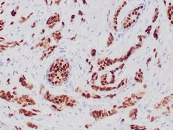 Progesterone Receptor Antibody