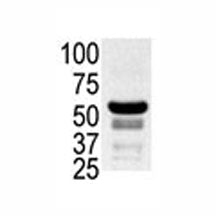 PAK2 Antibody