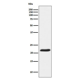 Western blot testing of human HeLa cell lysate with TCTP antibody. Predicted molecular weight ~20 kD
