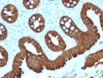 IHC testing of human colon with Cytokeratin 20 antibody (clone KRT20/1992). Required HIER: boil tiss
