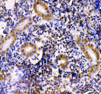 IHC staining of FFPE zebrafish kidney tissue with Zebrafish Hsd3b1 antibody, HRP-labeled secondary a
