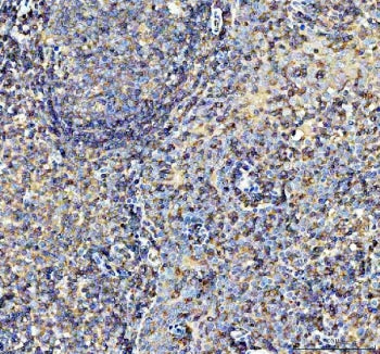 AIRE Antibody