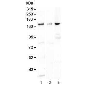 Western blot testing of 1) rat kidney, 2) mouse liver and 3) mouse HEPA1-6 lysaste with VEGF Recepto
