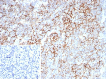 IHC staining of FFPE human tonsil tissue with LAG-3 antibody (clone LAG3/7380). Inset: PBS used in p