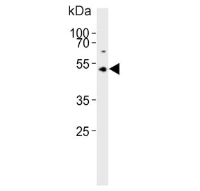 Western blot testing of human Y79 cell lysate with ASMT antibody. Predicted molecular weight ~38 kDa