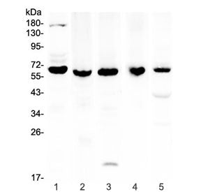 Western blot testing of 1) human K562, 2) rat brain, 3) rat PC-12, 4) mouse brain and 5) mouse HEPA1
