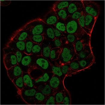 Immunofluorescence staining of PFA-fixed human MCF-7 cells with MSH6 antibody (green, clone MSH6/309