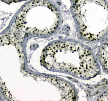 IHC testing of FFPE human testis tissue with MDC1 antibody at 1ug/ml. Required HIER: steam section i