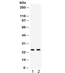 APOA1 Antibody / Apolipoprotein A I