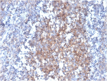 FasL Antibody / Fas Ligand