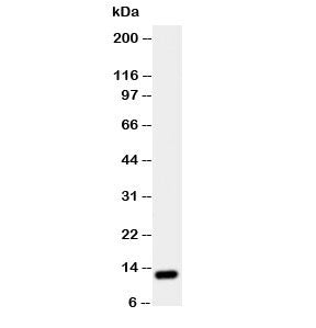 Western blot testing of TFF1 antibody and rat stomach tissue lysate. Predicted molecular weight ~12 