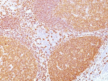 CD20 Antibody