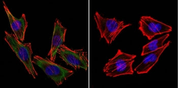 (Left) Confocal Immunofluorescent analysis of A2058 cells using S100 beta antibody (green). F-actin 