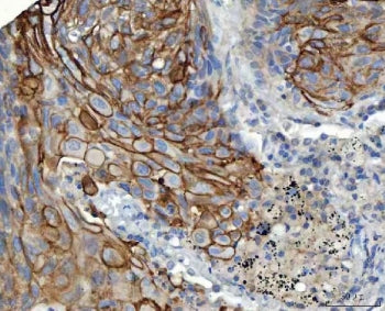S100A14 Antibody