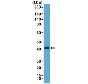 Western blot testing of human LNCaP cell lysate with recombinant AMACR antibody at 1:1000 dilution. 
