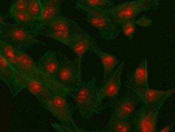Immunofluorescent staining of FFPE human A549 cells with PHF6 antibody (red) and Phalloidin-iFluor 4