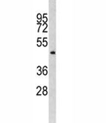 ILK Antibody