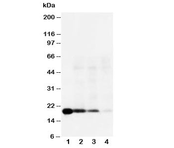 Western blot testing of IL-18 antibody and Lane 1: Recombinant human IL-18 protein 10ng; 2: 5ng; 3: 