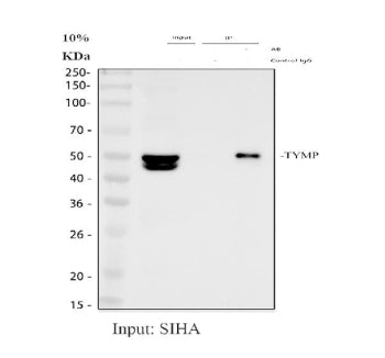 Immunoprecipitating PD-ECGF/TYMP in SiHa whole cell lysate. Western blot analysis of PD-ECGF/TYMP us