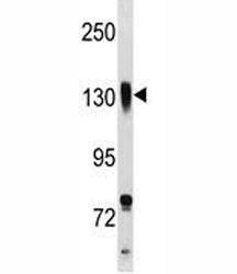 Integrin beta 1 Antibody