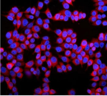 STMN1 Antibody / Stathmin 1