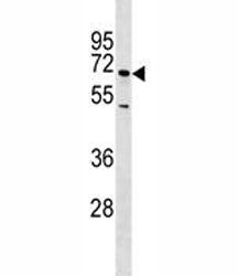 E-Selectin antibody western blot analysis in NCI-H460 lysate. Predicted molecular weight: 64-115 kDa