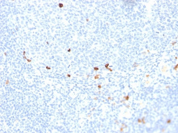 IHC staining of FFPE human tonsil with recombinant IgM antibody (clone rIGHM/1623). HIER: boil tissu