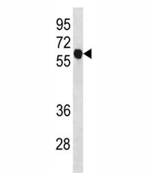 Cyclin B1 Antibody (CCNB1)
