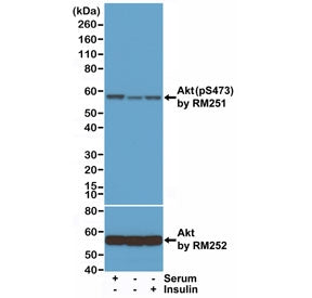 Western blot test of lysates from 293 cells grown in medium with serum, serum starved, or insulin tr