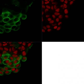 MUC1 Antibody / Mucin-1