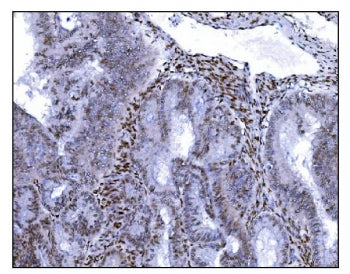SRF Antibody / Serum Response Factor