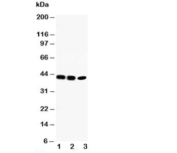 Western blot testing of CCR6 antibody and Lane 1: rat liver; 2: human SW620; 3: human CEM cell lysat