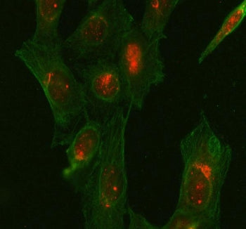 Glycogen synthase kinase-3 beta Antibody / GSK3B