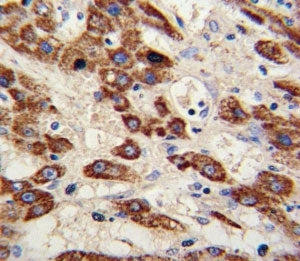 MMP3 Antibody