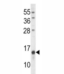 Osteocalcin antibody western blot analysis in U251 lysate. Predicted molecular weight: ~12 kDa