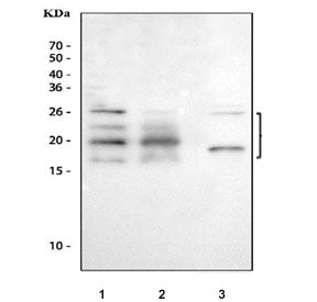 Western blot testing of 1) human HeLa, 2) human SK-O-V3 and 3) rat lung tissue lysate with FGF2 anti