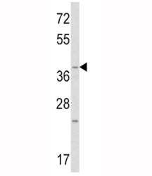 Western blot analysis of WNT1 antibody and mouse heart tissue lysate. Expected/observed molecular we