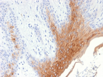 IHC testing of FFPE human skin with recombinant Cytokeratin 10 antibody (clone KRT10/1990R). Require