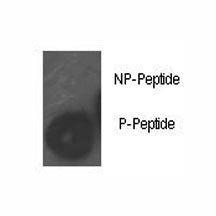 Dot blot analysis of phospho-Rb antibody. 50ng of phos-peptide or nonphos-peptide per dot were spott