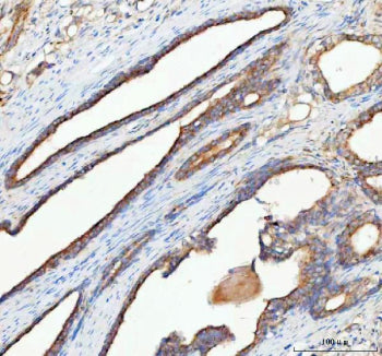 Immunohistochemical staining of RHOT2 using anti-RHOT2 antibody. RHOT2 was detected in a paraffin-em