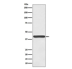 Western blot testing of human plasma lysate with Haptoglobin antibody. Predicted molecular weight: 4