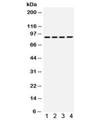 TGFBR2 Antibody / TGF beta Receptor II