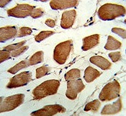 IHC testing of FFPE human skeletal muscle tissue with GSTO1 antibody. HIER: steam section in pH6 cit