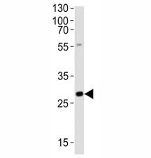 Olig3 Antibody
