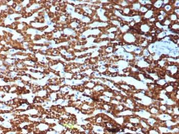 CPS1 Antibody / Carbamoyl phosphate synthetase 1