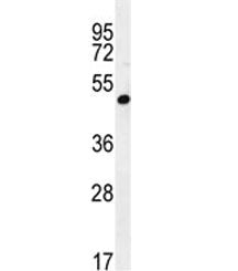 A4GALT Antibody