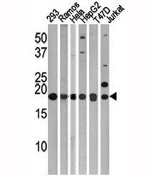 LC3C Antibody / MAP1LC3C, 0.08ml