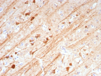 IHC staining of FFPE human brain tissue with MAP2 antibody (clone MAP2/7673). HIER: boil tissue sect